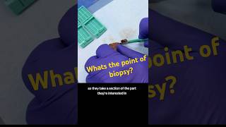 Whats the point of a biopsy humananatomy histology medicine histotechnology [upl. by Leduar]