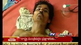 TV5  Another Rabies case filed in Rajahmundry [upl. by Fabozzi]