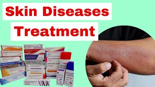 medicine for skin diseases  skin disease treatment  integumentary medication [upl. by Anertak]