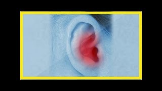 Comment déboucher les oreilles naturellement [upl. by Ainocal75]