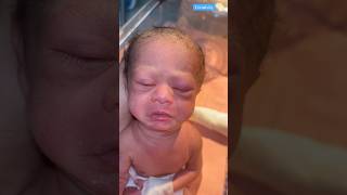 Newborn at Birth Video medical viralvideo [upl. by Noyk]