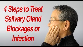 4 Steps to Treat Salivary Gland Swelling at Home [upl. by Ilrebma942]