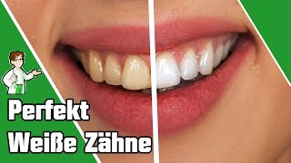 Perfekt weiße Zähne – So kannst du deine Zähne aufhellen 😁 [upl. by Yelah]