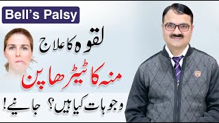 Bells Palsy Treatment  Causes Symptoms amp Exercises  Laqwa Ka Ilaj  By Dr Tariq Ali Sheikh [upl. by Aikenat]