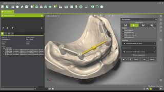 DWOS  How to add Attachments Dolder Mclip et Ackermann on a bar [upl. by Adria944]