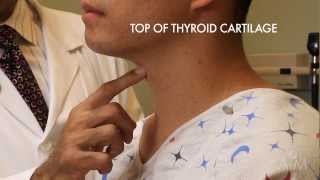 The Thyroid Exam Stanford Medicine 25 [upl. by Corry]