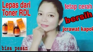 Lepas dari Toner RDL  cara agar kulit tetap glowing dan putih sehat selamanya [upl. by Kozloski921]