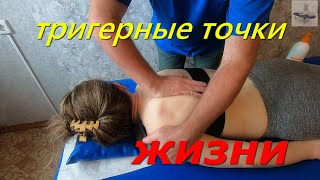 тригерные точки ЖИЗНИUdar leczeniakinezjologiaSTROKETREATMENT METHODSPREVENTIONKINESIOLOG [upl. by Ayerf932]