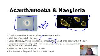 Acanthamoeba and Naegleria [upl. by Notgnirrac]