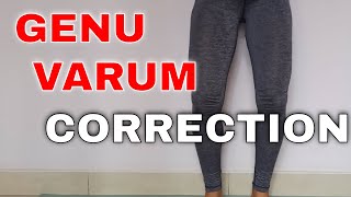 5 GENU VARUM CORRECTION EXERCISES  Yoga For Bow Legs [upl. by Kristofer302]