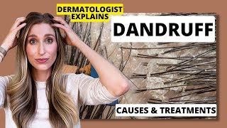 Dermatologist Explains Dandruff What Causes it amp Best Dandruff Treatments  Dr Sam Ellis [upl. by Nueovas]