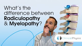 What’s the difference between Radiculopathy and Myelopathy  Expert Physio Guide [upl. by Yentruok357]