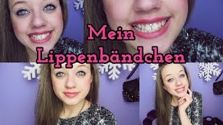 Mein LippenbändchenPiercing [upl. by Sheffy]