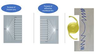 How Diffractive Multifocal IOLs work [upl. by Adi]