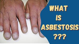 Asbestosis Asbestos disease Sign amp Symptoms Causes and risks [upl. by Dennet]