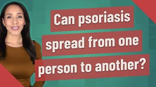 Can psoriasis spread from one person to another [upl. by Majka]