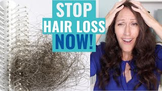 Homeopathics for Telogen Effluvium that STOP Hair Loss Naturally [upl. by Dorrehs840]