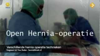 Verschillende hernia operatie technieken [upl. by Enaud]