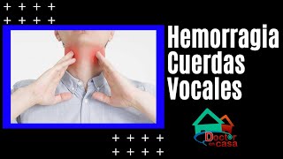 Hemorragia de cuerda vocal [upl. by Ariamoy]