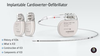 Implantable Cardioverter Defibrillator  ICD  Biomedical Engineers TV [upl. by Bolt]