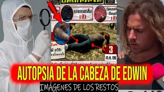 🟥 AUTOPSIA A LA CABEZA DE EDWIN ARRIETA E IMÁGENES DE LOS RESTOS DAN LA RAZÓN A DANIEL SANCHO [upl. by Jervis]