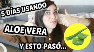 5 Días USANDO ALOE VERA en la CARA 😱💚  Erika Zárate [upl. by Eniarral]