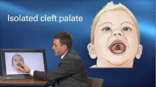 Cleft Treatment  Pediatric Playbook  Boston Childrens Hospital [upl. by Uyerta]