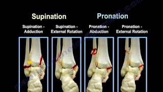 Ankle Fractures Lauge Hansen Introduction  Everything You Need To Know  Dr Nabil Ebraheim [upl. by Ylhsa6]