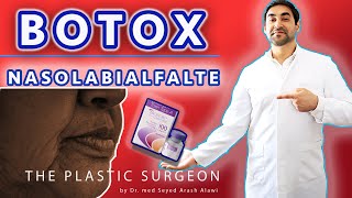 BOTOX  Nasolabialfalte  Nasolabial Fold  Dr Alawi [upl. by Hgielrac]