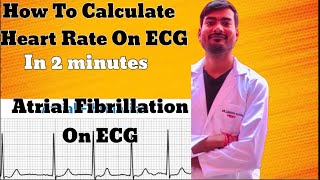 How To calculate Heart rate on ECG  What is Atrial fibrillation  Learn ECG in Easy way ECG Part 1 [upl. by Borer]