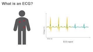 ECG Circuit  Project Lab 3 [upl. by Enelyw103]