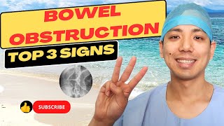 Do I have a small bowel obstruction Top 3 signs for small bowel obstruction and how to treat it [upl. by Joyce54]