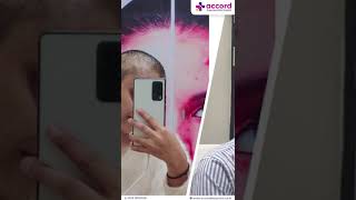 Success Story Alopecia Areata Treatment  Patient Testimonial  Dr Sonali Gupta [upl. by Eeldivad745]