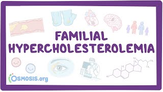 Familial hypercholesterolemia  an Osmosis Preview [upl. by Eiramannod]