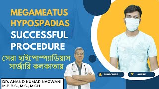 Best HYPOSPADIAS Surgery in Kolkata  MEGAMEATUS Hypospadias Surgery in Kolkata   By COSMO AID [upl. by Harras]