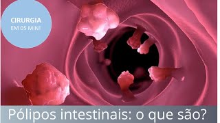 Pólipos intestinais o que são como diagnosticar e tratar  Fernando Eyer [upl. by Corty]