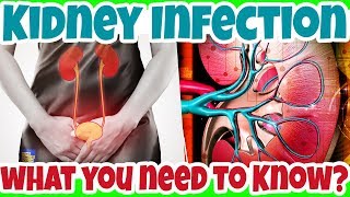 What You NEED to KNOW about KIDNEY INFECTION A Serious UTI Condition  Pyelonephritis [upl. by Perkin]