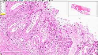 Description of histopathological slides in Gastrointestinal cases in animal english version [upl. by Deb]