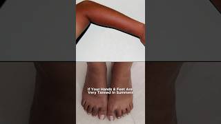 How to detan at home hands and feet tanning tan removal body lotion skincare dermatologist [upl. by Astto]