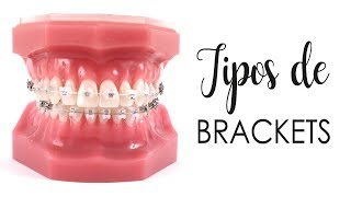 CONOCE LOS TIPOS DE BRACKETS  ¿CUÁLES SON MEJORES [upl. by Adnolahs]