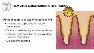 Acute GI Watery diarrhea and viruses [upl. by Aurel670]