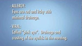 Causes of Red Eye [upl. by Ssitnerp]