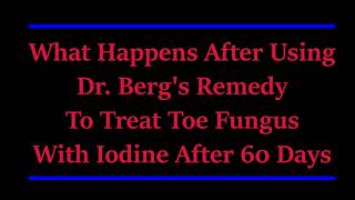 DR ERIC BERGS REMEDY ON TOENAIL FUNGUS IS PUT TO THE TEST FOR 60 DAYS [upl. by Lisette548]