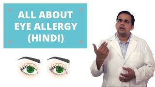 All about allergies of the eyes Dr Gaurav Jain [upl. by Lubin]