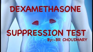 DEXAMETHASONE SUPPRESSION TEST CUSHING DISEASE  CUSHING SYNDROME  DEXAMETHASONE STRESS TEST [upl. by Tewell]