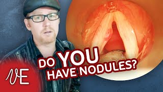 Do I Have Nodules  Nodes on Vocal Cords  DrDan 🎤 [upl. by Anertac]