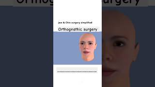 Orthognathic surgery shorts cristiano mbbs femalereproductivesystem [upl. by Nnalyrehc]