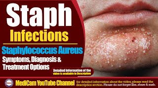 Staphylococcus Aureus Symptoms Treatment And Prevention [upl. by Adihahs]