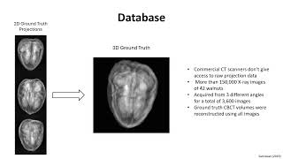 Differentiable Voxelbased Xray Rendering Improves SparseView 3D CBCT Reconstruction [upl. by Aimo]