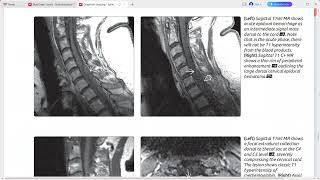 SPINE IMAGING DIAGNOSTIC IMAGING SERIES [upl. by Erny]